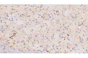 Detection of GFAP in Mouse Spinal cord Tissue using Polyclonal Antibody to Glial Fibrillary Acidic Protein (GFAP) (GFAP antibody  (AA 253-354))