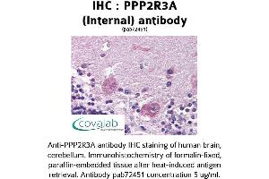 Image no. 1 for anti-Protein Phosphatase 2, Regulatory Subunit B'', alpha (PPP2R3A) (Internal Region) antibody (ABIN1738304) (PPP2R3A antibody  (Internal Region))