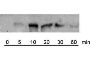 Image no. 1 for anti-V-Raf-1 Murine Leukemia Viral Oncogene Homolog 1 (RAF1) (pSer338) antibody (ABIN401545) (RAF1 antibody  (pSer338))