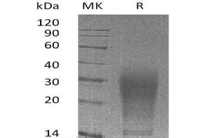 Western Blotting (WB) image for Interleukin 13 (IL13) (AA 22-131) (Active) protein (His tag) (ABIN7320574) (IL-13 Protein (AA 22-131) (His tag))