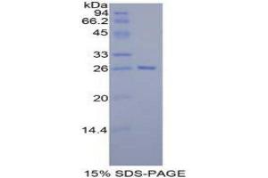 SDS-PAGE (SDS) image for Tafazzin (TAZ) (AA 46-240) protein (His tag) (ABIN2126915)