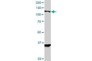 HIP1R monoclonal antibody (M01), clone 3E10. (HIP1R antibody  (AA 969-1066))