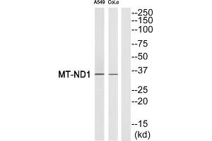 Western blot analysis of extracts from A549 cells and COLO cells, using MT-ND1 antibody. (MT-ND1 antibody  (Internal Region))