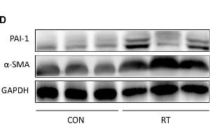 Establishment and confirmation of radiation-induced lung fibrosis in a murine model. (GAPDH antibody)