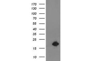 HEK293T cells were transfected with the pCMV6-ENTRY control (Left lane) or pCMV6-ENTRY DSTN (Right lane) cDNA for 48 hrs and lysed. (Destrin antibody)