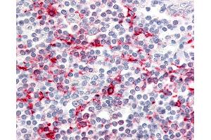 Anti-CCR6 antibody IHC of human tonsil. (CCR6 antibody  (C-Term))