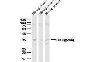 Lane 1-3: His Tagged protein lysates probed with His tag (2D5) Monoclonal Antibody  at 1:300 overnight at 4˚C.