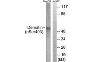 Western blot analysis of extracts from HepG2 cells treated with Insulin 0. (Dematin antibody  (pSer403))