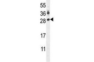 LIN28A antibody western blot analysis in mouse Neuro-2a lysate.