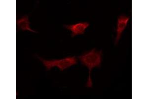 ABIN6267280 staining Hela by IF/ICC. (RAF1 antibody  (pSer296))
