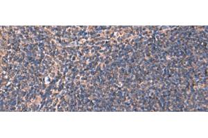 Immunohistochemistry of paraffin-embedded Human tonsil tissue using RHAG Polyclonal Antibody at dilution of 1:130(x200) (RHAG antibody)