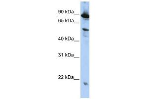 ZGPAT antibody used at 1 ug/ml to detect target protein. (ZGPAT antibody  (N-Term))