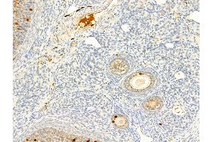 ABIN6256005 and ABIN6267245 at 1/100 staining Rat ovary tissue by IHC-P.