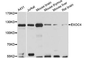 Western blot analysis of extracts of various cell lines, using EXOC4 antibody (ABIN6290368) at 1:3000 dilution.