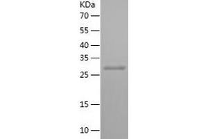 HRPT2 Protein (AA 2-260) (His tag)