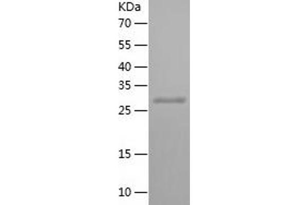 HRPT2 Protein (AA 2-260) (His tag)