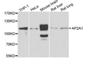 Western blot analysis of extracts of various cell lines, using AP2A1 antibody. (alpha Adaptin antibody  (AA 1-260))