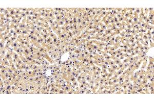 Detection of AST in Mouse Liver Tissue using Monoclonal Antibody to Aspartate Aminotransferase (AST) (GOT1 antibody  (AA 1-413))
