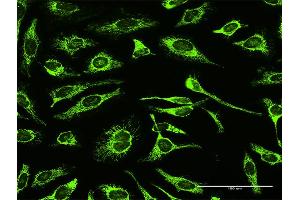 Immunofluorescence of purified MaxPab antibody to TRAP1 on HeLa cell. (TRAP1 antibody  (AA 1-704))