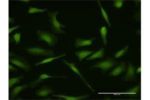 Immunofluorescence of purified MaxPab antibody to MDM4 on HeLa cell. (MDM4-binding Protein antibody  (AA 1-490))