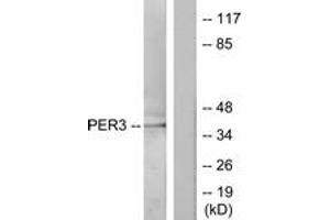 Western blot analysis of extracts from Jurkat cells, treated with insulin 0. (PER3 antibody  (AA 21-70))