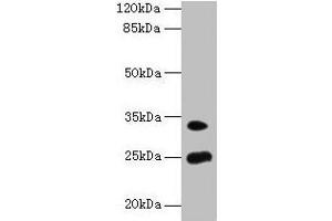 Western blot All lanes: MREG antibody at 8 μg/mL + Mouse stomach tissue Secondary Goat polyclonal to rabbit IgG at 1/10000 dilution Predicted band size: 25, 27 kDa Observed band size: 25, 33 kDa (MREG antibody  (AA 1-214))