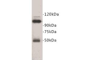 Western Blotting (WB) image for anti-Melanoma Cell Adhesion Molecule (MCAM) (Extracellular) antibody (ABIN1854854) (MCAM antibody  (Extracellular))