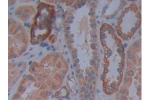 DAB staining on IHC-P; Samples: Human Kidney Tissue (Cadherin 4 antibody  (AA 667-916))