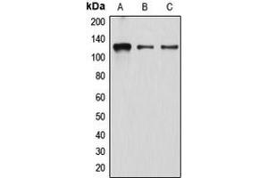 Western blot analysis of Atrophin-1 expression in K562 (A), EOC20 (B), HeLa (C) whole cell lysates. (Atrophin 1 antibody  (N-Term))
