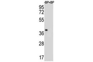 Western blot analysis of MBP antibody and NCI-H460 lysate. (MBP antibody  (AA 177-209))