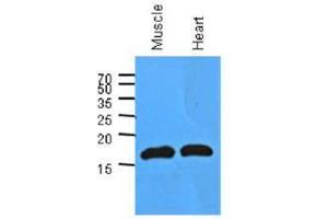 Image no. 1 for anti-Myoglobin (MB) (AA 1-154), (N-Term) antibody (ABIN953585) (Myoglobin antibody  (N-Term))