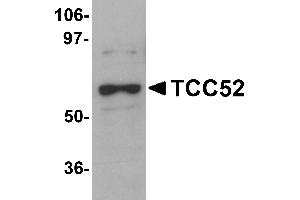 Western Blotting (WB) image for anti-DDB1 and CUL4 Associated Factor 12 (DCAF12) (C-Term) antibody (ABIN1030723) (DCAF12 antibody  (C-Term))