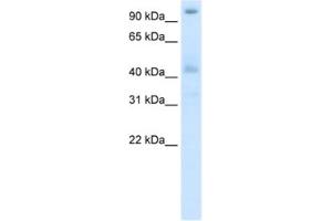 Western Blotting (WB) image for anti-Pogo Transposable Element with ZNF Domain (POGZ) antibody (ABIN2461864) (POGZ antibody)