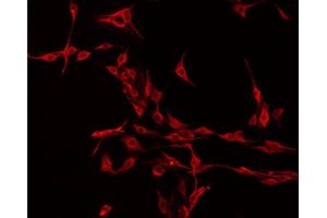 ABIN6275303 staining Hela by IF/ICC. (NMS antibody  (C-Term))