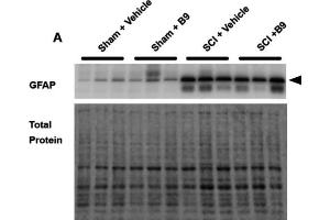Western blot showing a band at the molecular weight corresponding to GFAP (cat. (GFAP antibody  (AA 411-422))