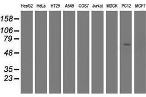 Western blot analysis of extracts (35 µg) from 9 different cell lines by using anti-EPM2AIP1 monoclonal antibody. (EPM2AIP1 antibody)