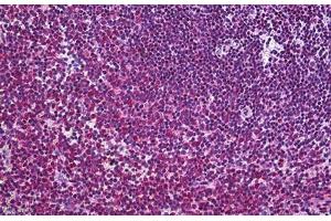 Human Spleen: Formalin-Fixed, Paraffin-Embedded (FFPE) (FLIP antibody  (AA 178-277))
