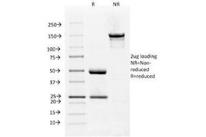 SDS-PAGE Analysis of Purified, BSA-Free VEGFR1 Antibody (clone FLT1/658). (FLT1 antibody)