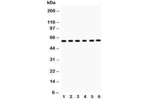 Western blot testing of EAAT2 antibody and Lane 1:  rat brain