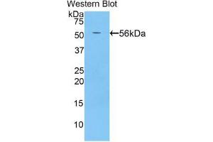 Western blot analysis of the recombinant protein. (BACE2 antibody  (AA 242-502))