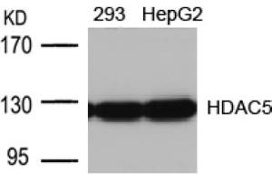 Image no. 1 for anti-Histone Deacetylase 5 (HDAC5) (AA 496-500) antibody (ABIN197340) (HDAC5 antibody  (AA 496-500))