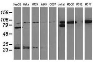 Image no. 6 for anti-Catenin (Cadherin-Associated Protein), beta 1, 88kDa (CTNNB1) antibody (ABIN1496890) (CTNNB1 antibody)