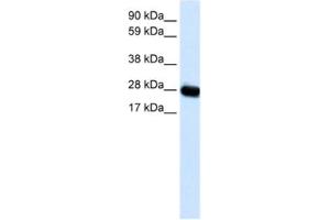 Western Blotting (WB) image for anti-Caveolin 3 (CAV3) antibody (ABIN2463712) (Caveolin 3 antibody)