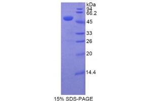 SDS-PAGE (SDS) image for Noggin (NOG) (AA 116-232) protein (His tag,GST tag) (ABIN2123402) (NOG Protein (AA 116-232) (His tag,GST tag))