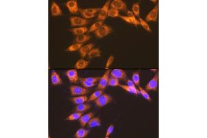 Immunofluorescence analysis of NIH-3T3 cells using PGE Receptor EP2 (PGE Receptor EP2 (PGE receptor EP2 (PTGER2))) Rabbit mAb (ABIN7269572) at dilution of 1:100 (40x lens). (PTGER2 antibody)