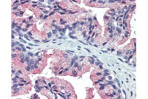 Anti-TM9SF3 antibody IHC of prostate, human. (TM9SF3 antibody  (Internal Region))