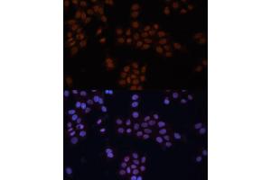 Immunofluorescence analysis of HeLa cells using GTF2I antibody (ABIN6129629, ABIN6141510, ABIN6141512 and ABIN6216068) at dilution of 1:100. (GTF2I antibody  (AA 600-810))