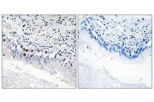 Immunohistochemistry (IHC) image for anti-Mediator Complex Subunit 12 (MED12) (Internal Region) antibody (ABIN1849872) (MED12 antibody  (Internal Region))