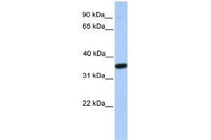 WB Suggested Anti-MOGAT1 Antibody Titration:  0. (MOGAT1 antibody  (C-Term))