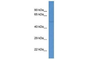 Western Blot showing Fkrp antibody used at a concentration of 1. (FKRP antibody  (C-Term))
